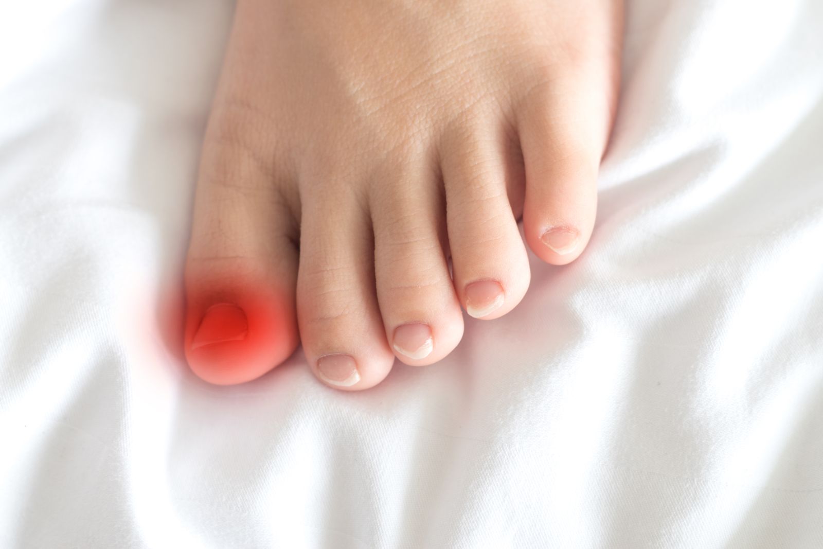 8 Tips for Treating Ingrown Toenails in North Seattle | Foot and Ankle  Center of Lake City