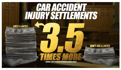 auto accident lawyer Think