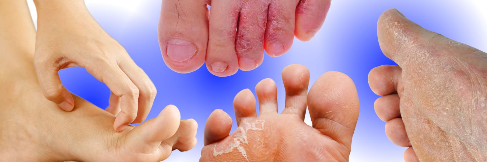 Why Do My Feet Itch At Night? | Sol Foot & Ankle Centers