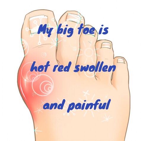 My Big Toe Is Hot Red Swollen And Painful Indiana Podiatry Group