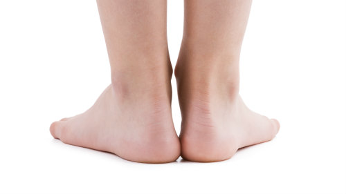 living with heel spurs