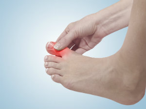What Is Gout Pain In The Toe